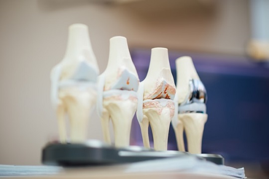 Medical-Devices-and-Implants